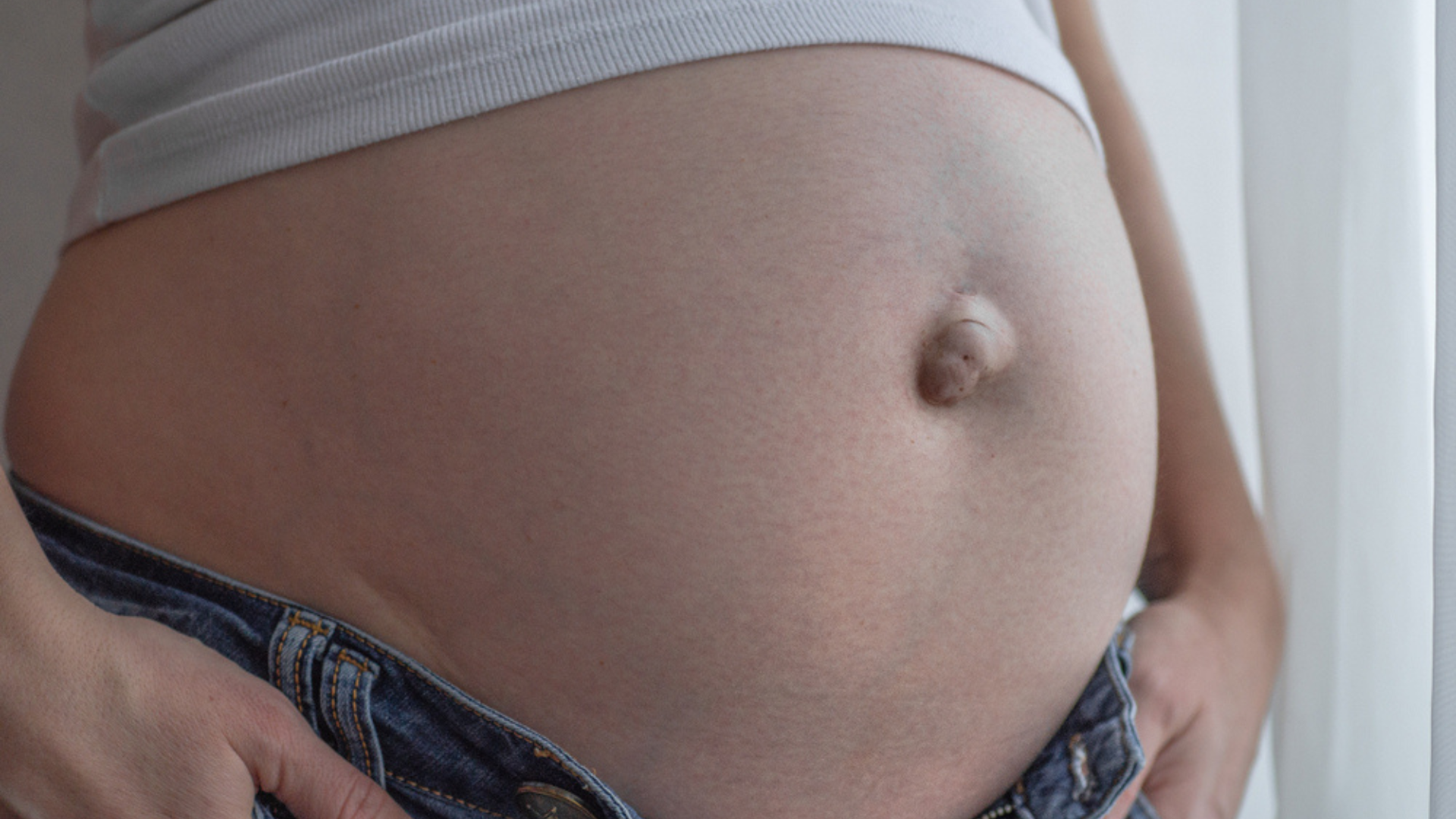 ομφαλοκήλη, Ομφαλοκήλη, Δρ. Δαρδαμάνης Δημήτριος