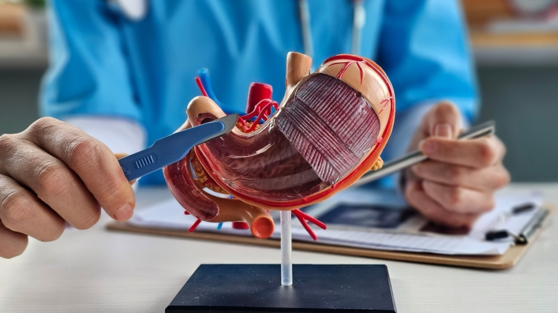 γαστρικό μανίκι (sleeve), Γαστρικό μανίκι (sleeve), Δρ. Δαρδαμάνης Δημήτριος